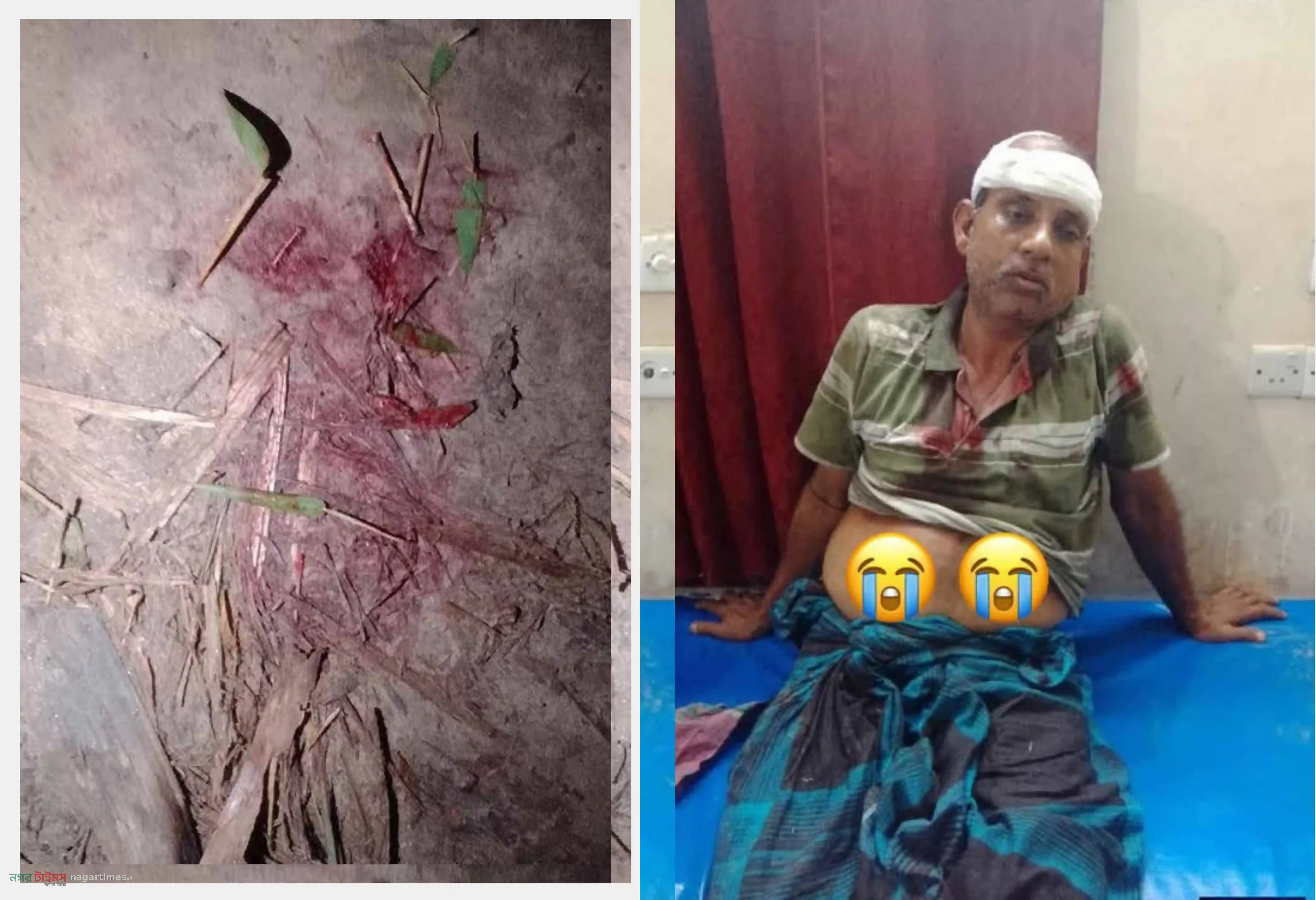 কুমিল্লার মুরাদনগরে বাড়ি ফেরার পথে উত্তম দাস নামের এক ব্যক্তির ওপর হামলা, হাসপাতালে চিকিৎসাধীন